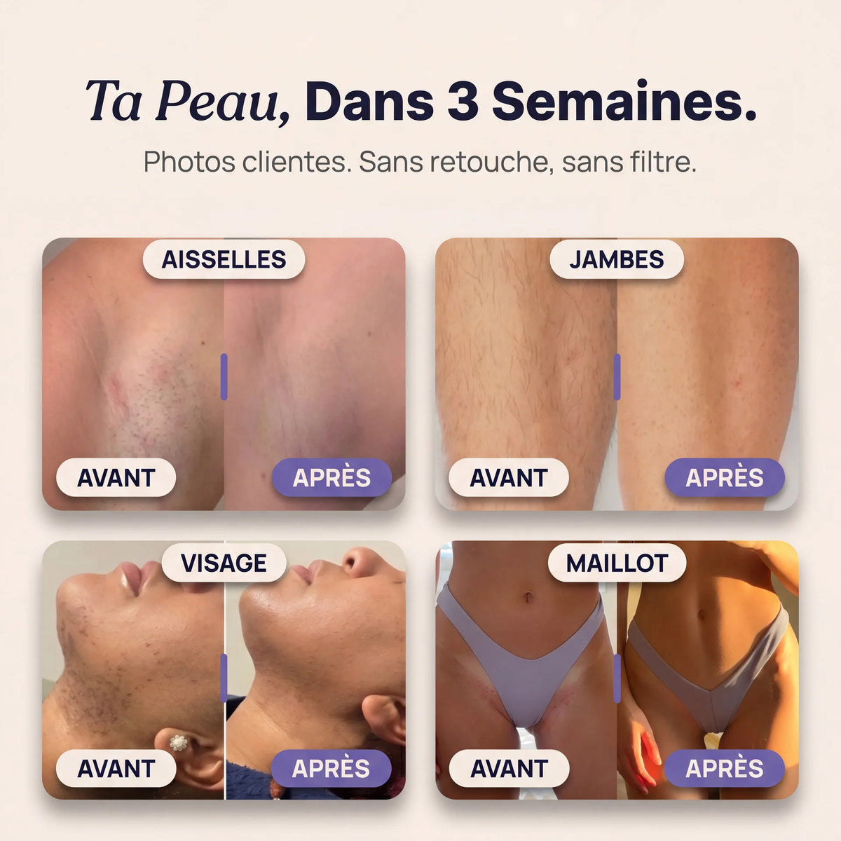 Tondeuse Élane 2.0 (Copy)