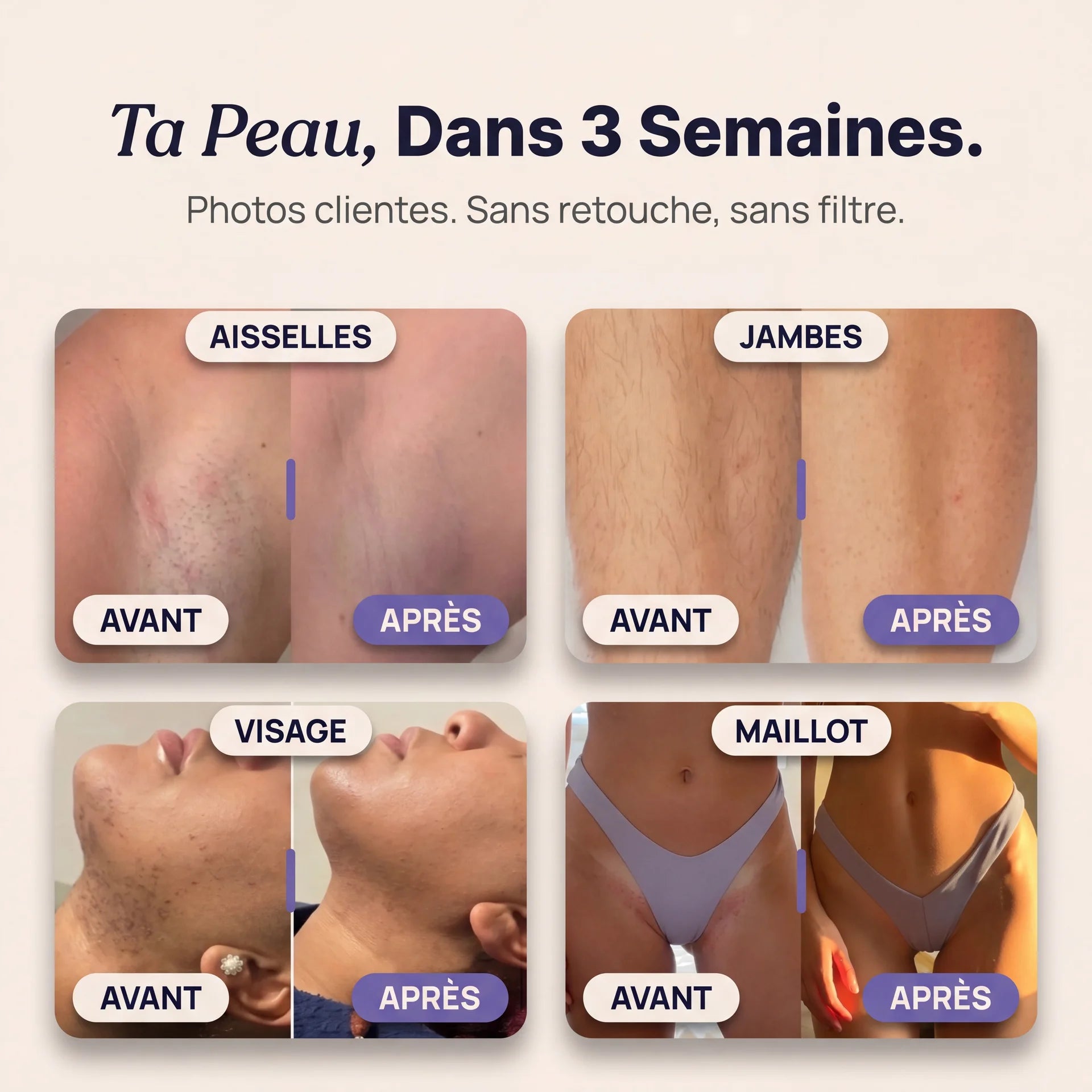 Tondeuse Élane 2.0